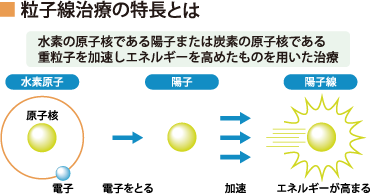 粒子線治療の特長とは