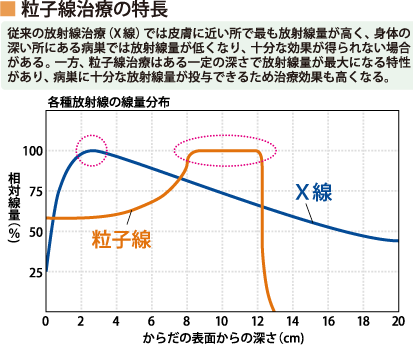 粒子線治療の特長